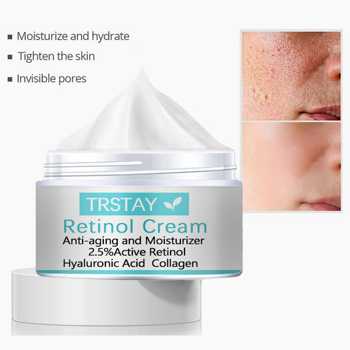 Whitening Freckles Cream Remove Melasma Dark Spots Lighten Melanin Melasma Remover Moisturizing Brighten Face Skin Care