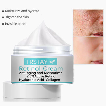 Whitening Freckles Cream Remove Melasma Dark Spots Lighten Melanin Melasma Remover Moisturizing Brighten Face Skin Care