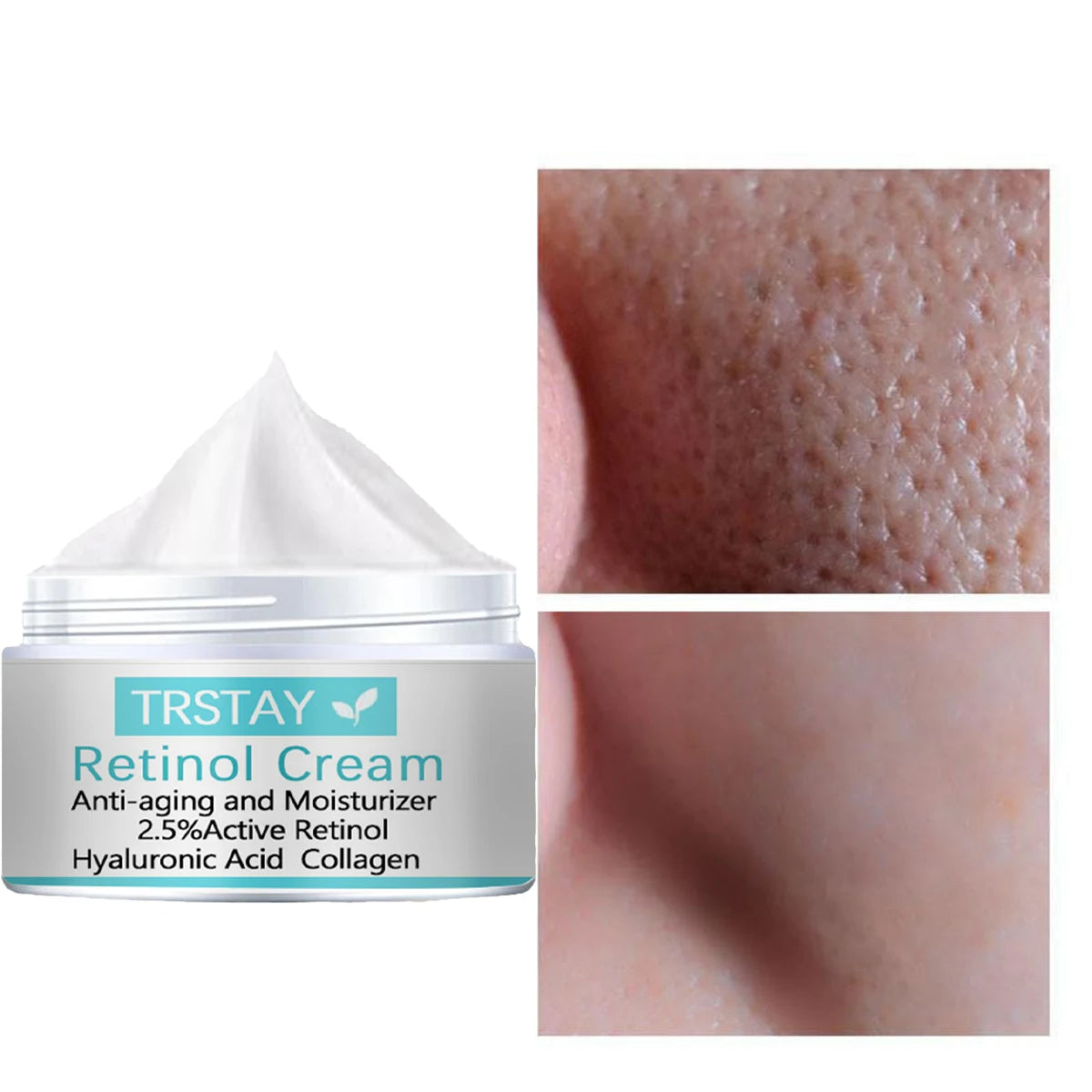 Whitening Freckles Cream Remove Melasma Dark Spots Lighten Melanin Melasma Remover Moisturizing Brighten Face Skin Care