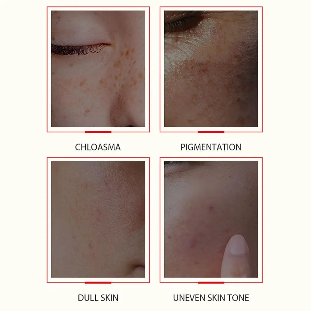 Kojic Acid Facial Serum Dark Spots Remove Whitening Brightening Essence Improve Roughness Moisturizing for Sensitive Skin Care