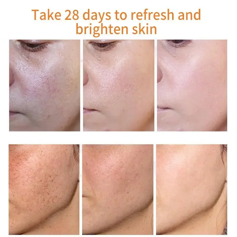 Whitening Freckles Cream Remove Melasma Dark Spots Lighten Melanin Melasma Remover Moisturizing Brighten Face Skin Care