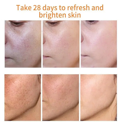 Whitening Freckles Cream Remove Melasma Dark Spots Lighten Melanin Melasma Remover Moisturizing Brighten Face Skin Care
