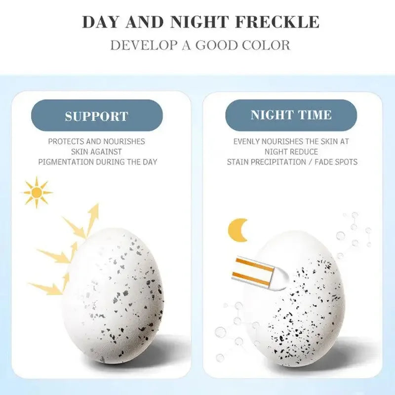 Whitening Freckles Cream Remove Melasma Dark Spots Lighten Melanin Melasma Remover Moisturizing Brighten Face Skin Care