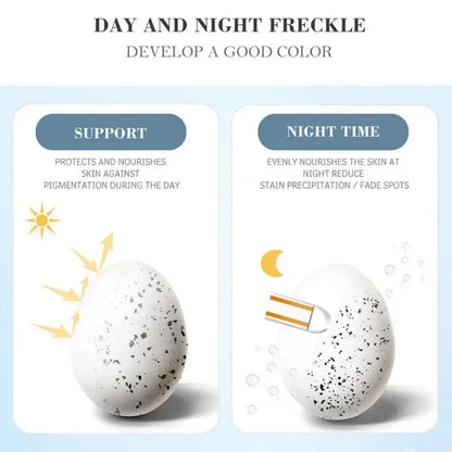 Whitening Freckles Cream Remove Melasma Dark Spots Lighten Melanin Melasma Remover Moisturizing Brighten Face Skin Care
